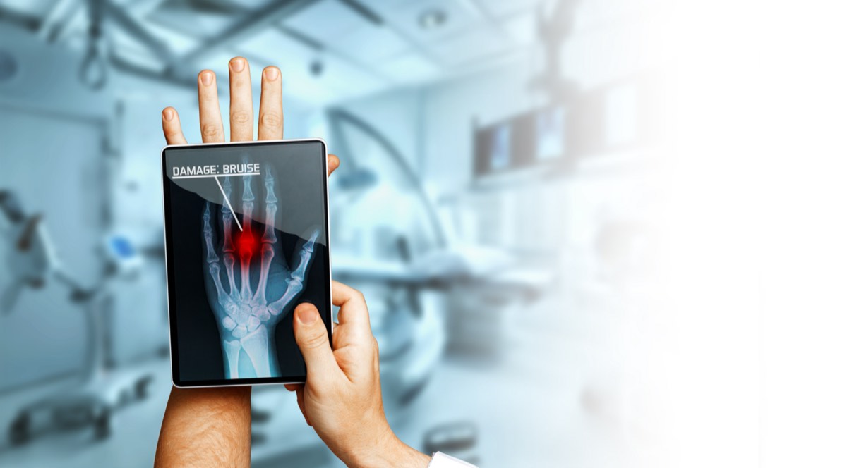 Digital X-ray of a hand shown on a tablet